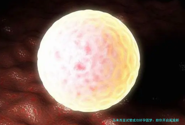马来西亚试管成功好孕圆梦：助你开启家庭新篇章