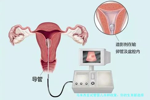 马来西亚试管婴儿冻卵政策：你的生育新选择
