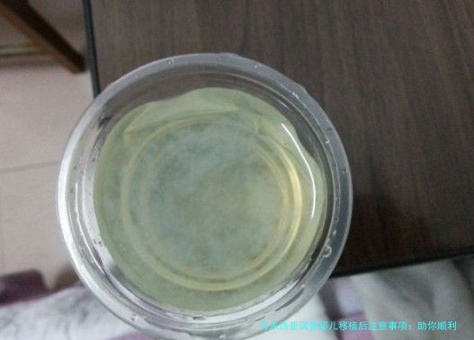 马来西亚试管婴儿移植后注意事项：助你顺利好孕的实用指南