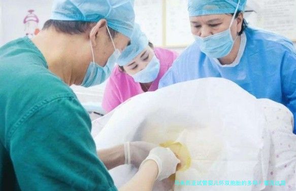 马来西亚试管婴儿怀双胞胎的多吗？看完这篇你就懂了