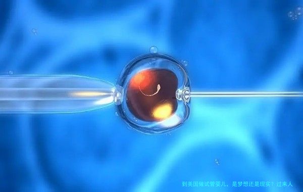 到美国做试管婴儿，是梦想还是现实？过来人聊聊真实经历