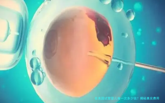 在美国试管婴儿做一次多少钱？揭秘真实费用构成