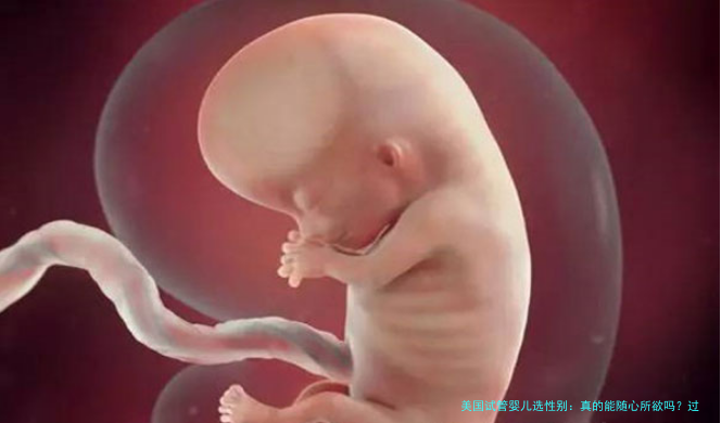 美国试管婴儿选性别：真的能随心所欲吗？过来人说出大实话
