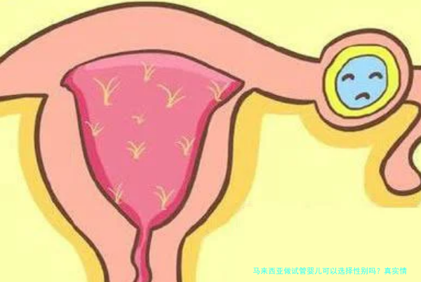 马来西亚做试管婴儿可以选择性别吗？真实情况一次说清
