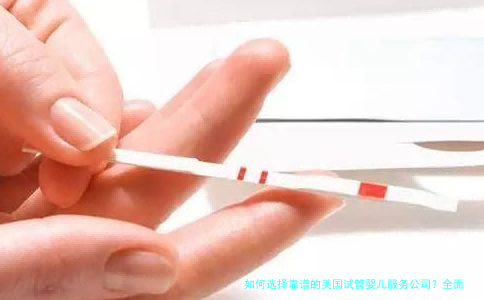 如何选择靠谱的美国试管婴儿服务公司？全面解析美国试管婴儿优势与避坑指南