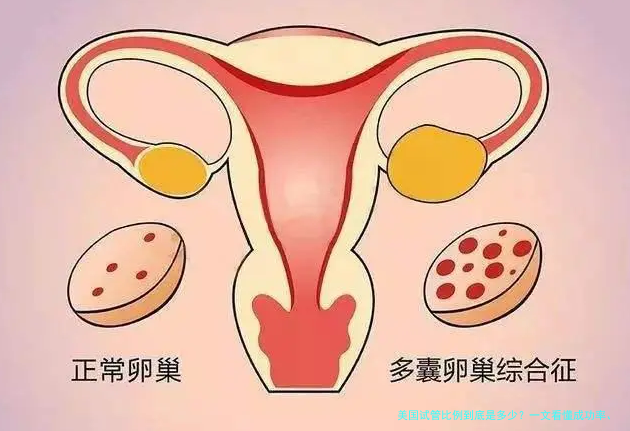 美国试管比例到底是多少？一文看懂成功率、年龄和性别选择