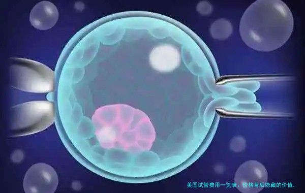 美国试管费用一览表：价格背后隐藏的价值，你真的懂吗？