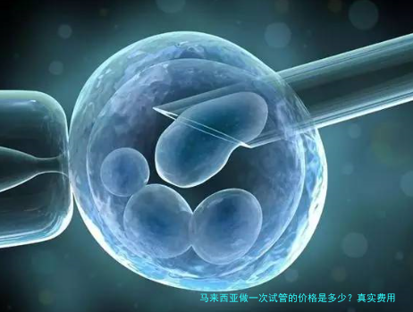马来西亚做一次试管的价格是多少？真实费用与省钱攻略全解析