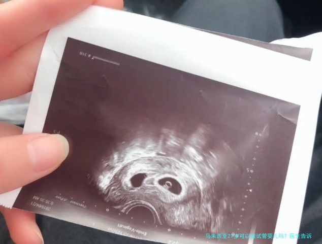 马来西亚27岁可以做试管婴儿吗？医生告诉你真相