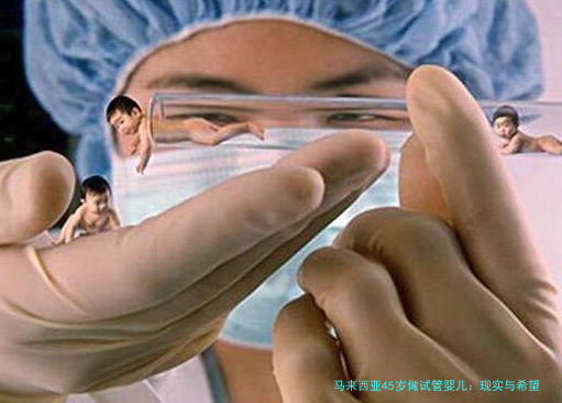 马来西亚45岁做试管婴儿:现实与希望