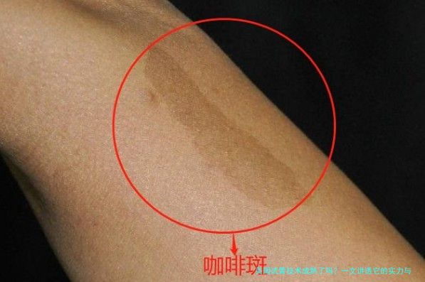 美国试管技术成熟了吗？一文讲透它的实力与局限