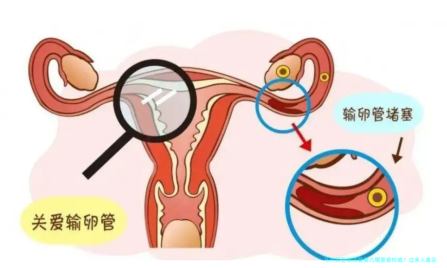 马来西亚做试管婴儿哪里最权威？过来人真实经验分享