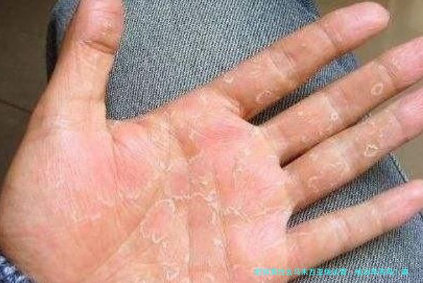 肥胖男性去马来西亚做试管，成功率高吗？真实情况一文说清