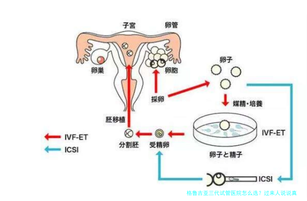 格鲁吉亚三代试管医院怎么选?过来人说说真实体验和避坑指南