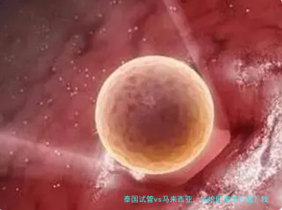 泰国试管vs马来西亚，姑娘们该怎么选？我的真实看法