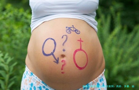 格鲁吉亚试管婴儿成功案例:高龄、多囊、染色体异常,她们最后都怀上了!