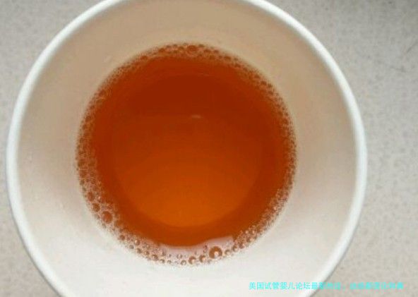 美国试管婴儿论坛最新热议：这些新变化和真实经验值得一看