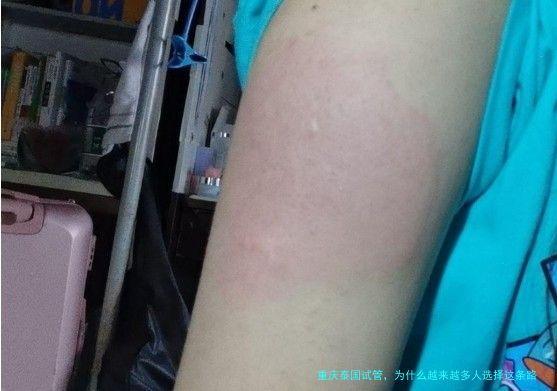 重庆泰国试管,为什么越来越多人选择这条路?