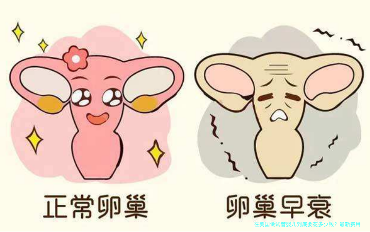 在美国做试管婴儿到底要花多少钱？最新费用明细与省钱攻略