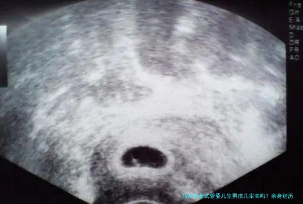 马来西亚试管婴儿生男孩几率高吗？亲身经历和科学数据告诉你