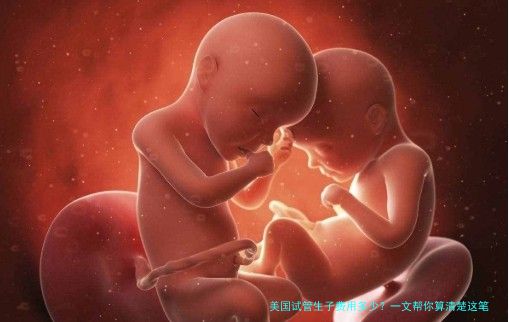 美国试管生子费用多少？一文帮你算清楚这笔账