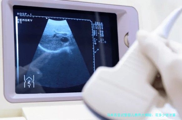 马来西亚试管婴儿费用大揭秘：花多少钱才算合理？