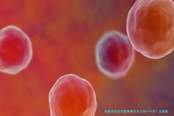 格鲁吉亚助孕套餐要花多少钱一个月?这笔账我给你算明白