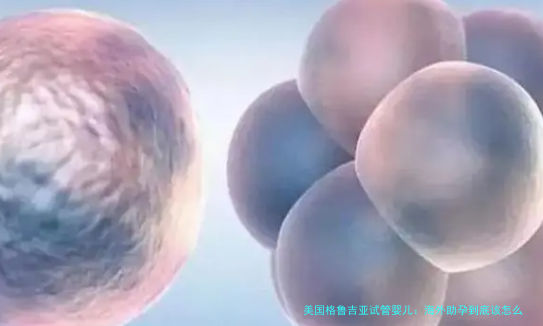 美国格鲁吉亚试管婴儿:海外助孕到底该怎么选?