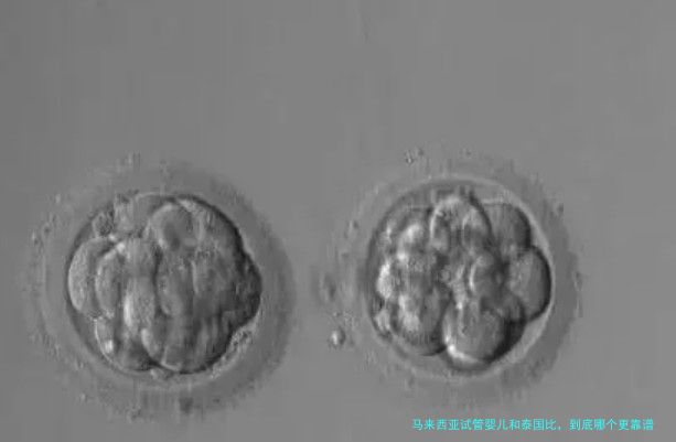 马来西亚试管婴儿和泰国比，到底哪个更靠谱？过来人说说大实话