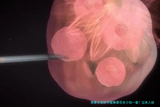 格鲁吉亚助孕套餐要花多少钱一套？过来人给你算笔明白账