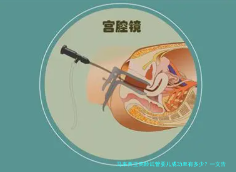 马来西亚高龄试管婴儿成功率有多少?一文告诉你真相!