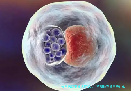 去马来西亚做试管婴儿,前期检查都查些什么?