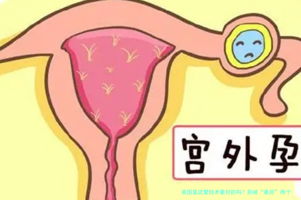 美国是试管技术最好的吗?别被“最好”两个字忽悠了