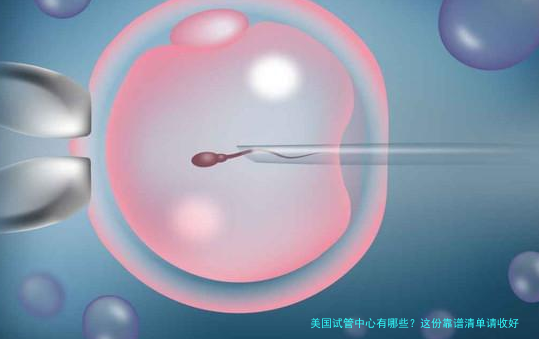 美国试管中心有哪些？这份靠谱清单请收好