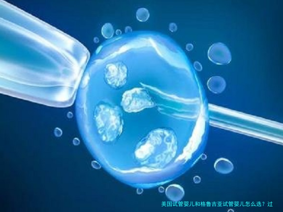 美国试管婴儿和格鲁吉亚试管婴儿怎么选?过来人大实话