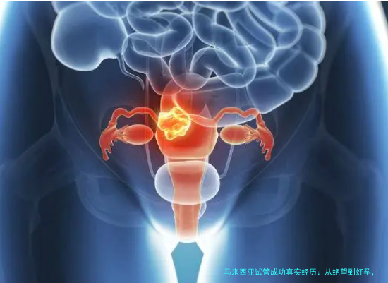 马来西亚试管成功真实经历：从绝望到好孕，我的亲身体验