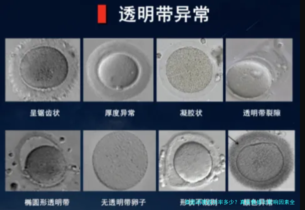 泰国试管成功率多少?真实数据与影响因素全解析
