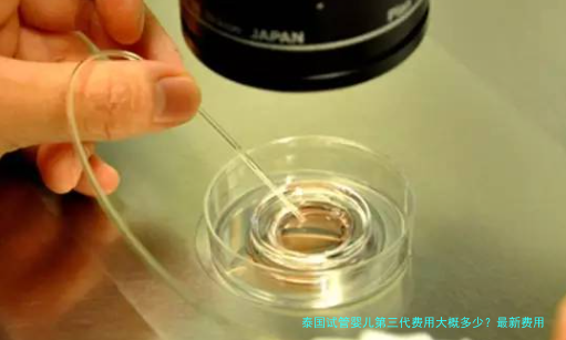 泰国试管婴儿第三代费用大概多少?最新费用明细与避坑经验