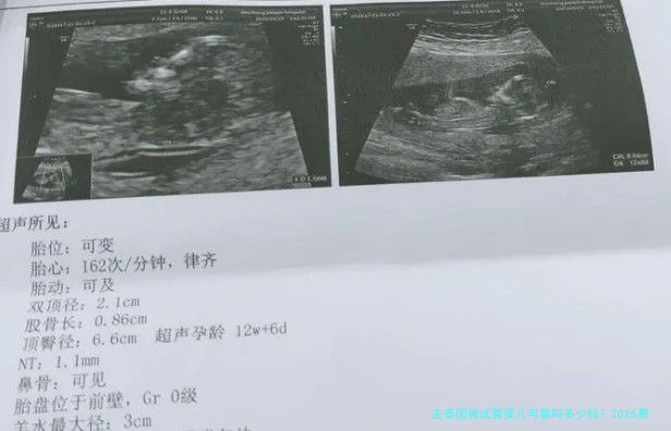去泰国做试管婴儿可靠吗多少钱?2026费用、成功率与避坑指南